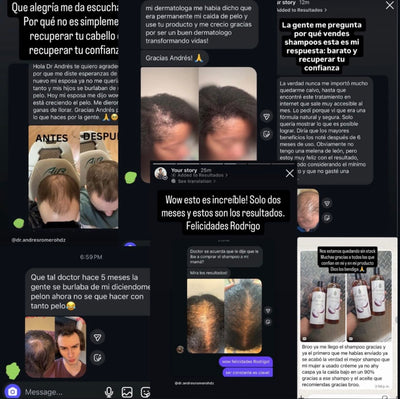 Grow Your Hair Back Naturally, or We'll Give You Your Money Back