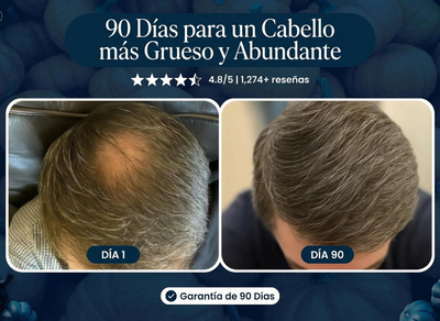 Grow Your Hair Back Naturally, or We'll Give You Your Money Back